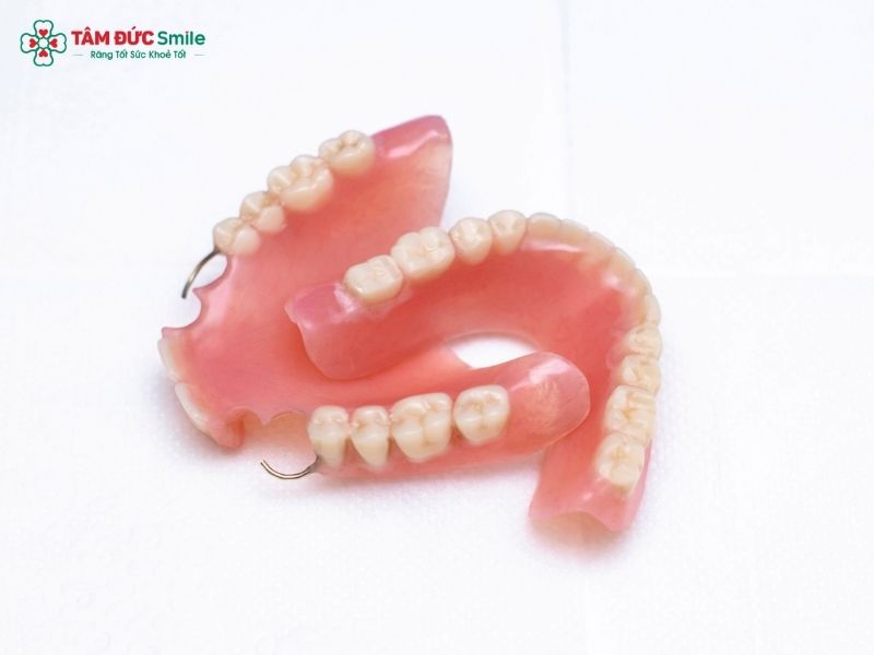 alternative-to-tooth-implant-2