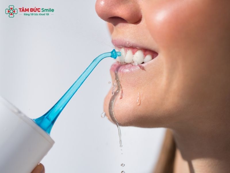 cleaning-dental-implants-1