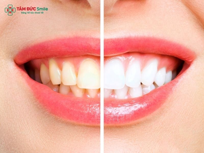 cosmetic-dentistry-2