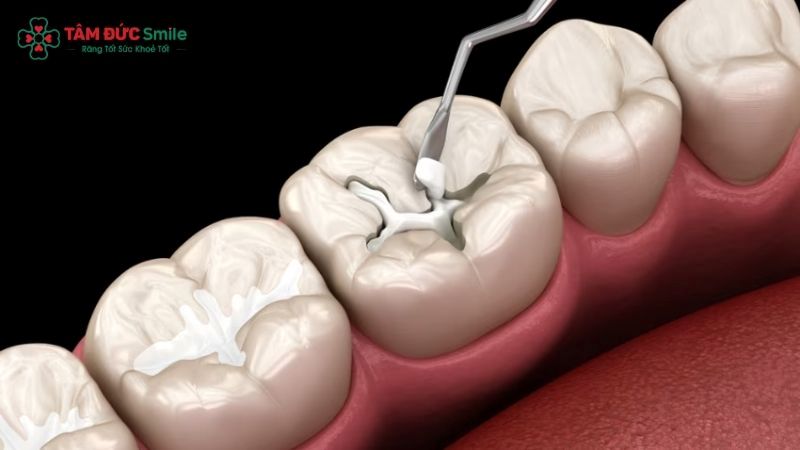 cosmetic-dentistry-3