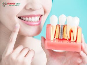 dental-implant-aftercare-3