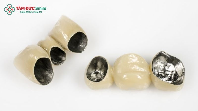 dental-implant-crown-3