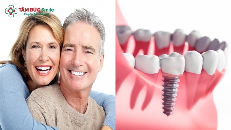 dental-implants-for-seniors-3