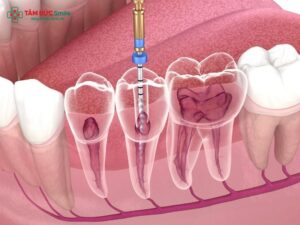 endodontics-1