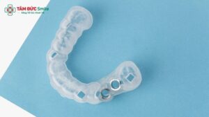 implant-surgical-guide-1