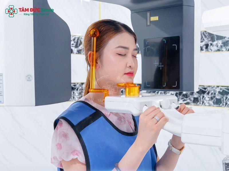 multiple-tooth-implants-3