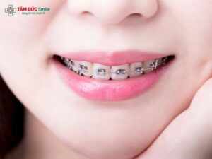 orthodontics-1