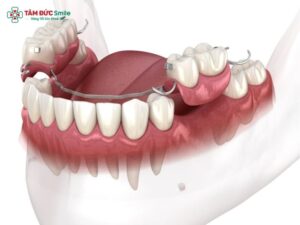 prosthodontics-1
