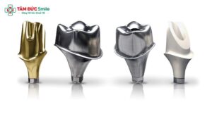 Abutment-Implant-gia-bao-nhieu-1