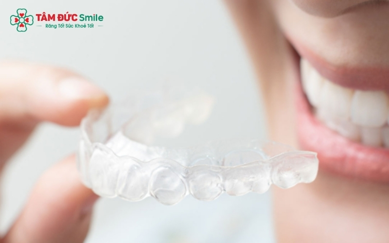 Bảo quản và vệ sinh khay niềng đúng cách là yếu tố quan trọng giúp răng dịch chuyển thuận lợi và đảm bảo sức khỏe răng miệng.