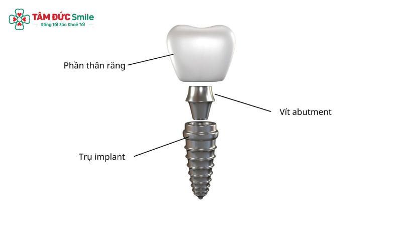 cay-ghep-implant-2