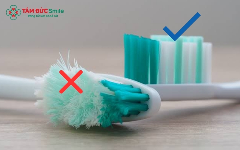 Bàn chải lông mềm và kem đánh răng Fluoride là "bộ đôi" hoàn hảo để bảo vệ men răng.