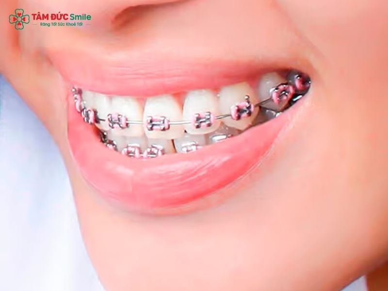 chinh-ham-ho-gia-bao-nhieu-tien-868-2