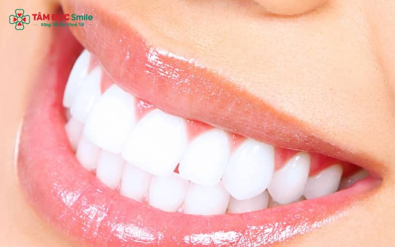 Tình trạng răng mọc thiếu hoặc thừa làm thay đổi khớp cắn, giảm hiệu quả ăn nhai và ảnh hưởng thẩm mỹ khuôn mặt