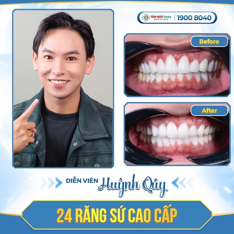 dv-huynh-quy