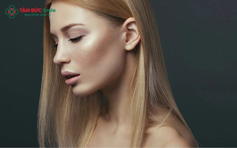 Gò má cao là tình trạng xương gò má nhô cao và lộ rõ