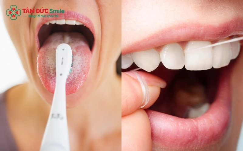 Kết hợp vệ sinh lưỡi và làm sạch kẽ răng bằng chỉ nha khoa mỗi ngày là bước quan trọng để kiểm soát vi khuẩn gây mùi hiệu quả