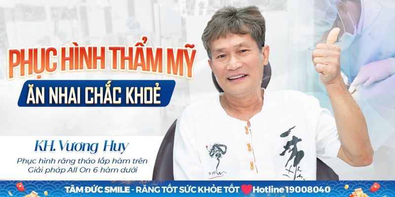 implant-all-on-6-la-gi-khi-nao-nen-trong-implant-all-on-6-1