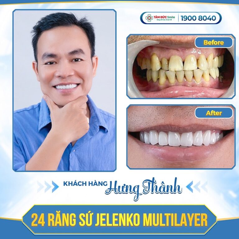 khach-hang-hung-thanh