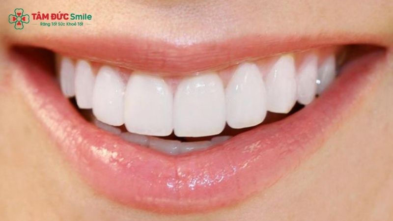 lam-4-rang-cua-boc-su-co-duoc-khong-1192-1
