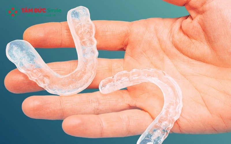Máng chống nghiến cá nhân hóa tại Nha khoa Tâm Đức Smile giúp ngăn chặn sự cọ xát trực tiếp, bảo vệ men răng tuyệt đối.