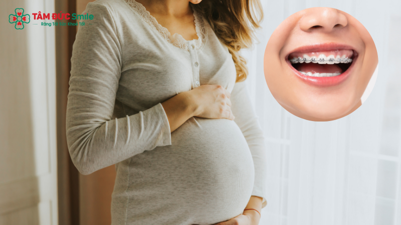 Niềng răng khi mang thai cần được bác sĩ theo dõi chặt chẽ để đảm bảo an toàn