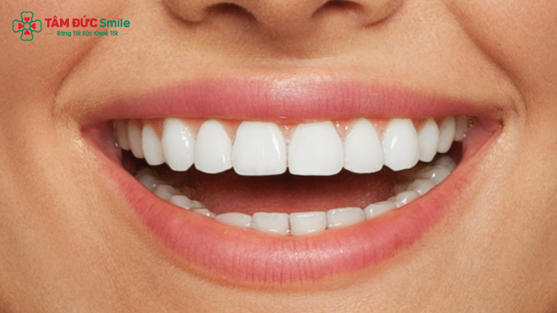 Hàm răng đều và trắng sáng thường được xem là dấu hiệu cát tường trong nhân tướng học