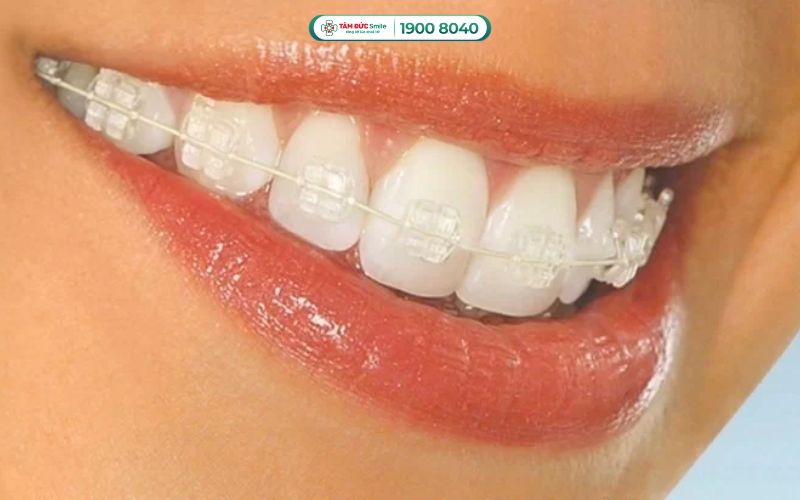 Thẩm mỹ cao, gần như trong suốt
