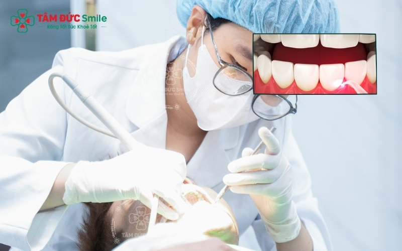 Vệ sinh răng miệng, lấy cao răng định kỳ giúp ngăn ngừa viêm nướu và tụt nướu gây ê buốt.