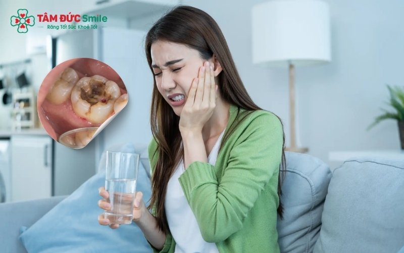 Cơn đau răng sâu vào tủy thường dữ dội, đau nhói lên đầu và đặc biệt đau nhiều về đêm