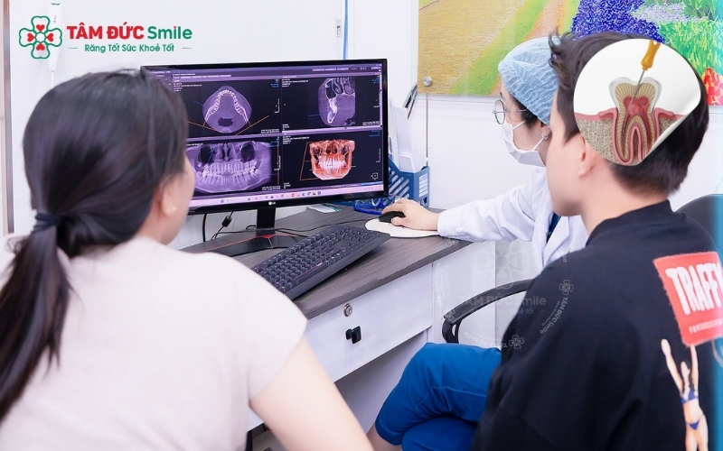 Quy trình điều trị tại Nha khoa Tâm Đức Smile giúp loại bỏ hoàn toàn vi khuẩn và bảo tồn răng thật tối đa.