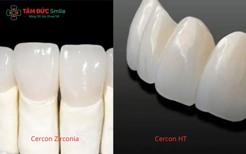Cercon HT (phải) có độ trong và xuyên sáng cao hơn, trong khi Cercon Zirconia (trái) ưu tiên độ bền cứng cho các răng hàm ăn nhai