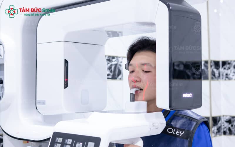 Tại Tâm Đức Smile, CT Cone Beam mang đến hình ảnh 3D rõ nét, hỗ trợ lập kế hoạch điều trị tối ưu