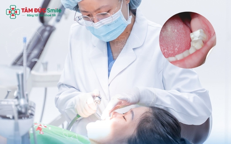 Điều trị tủy răng hàm giúp loại bỏ ổ nhiễm trùng, chấm dứt cơn đau và bảo tồn răng thật tối đa tại Nha khoa Tâm Đức Smile.