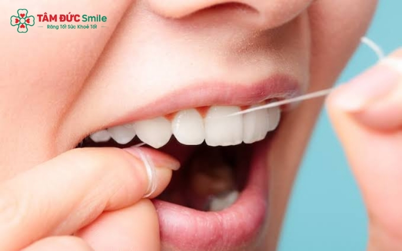 Sử dụng chỉ nha khoa là cách tốt nhất để làm sạch kẽ răng hàm - nơi bàn chải thường không chạm tới được.