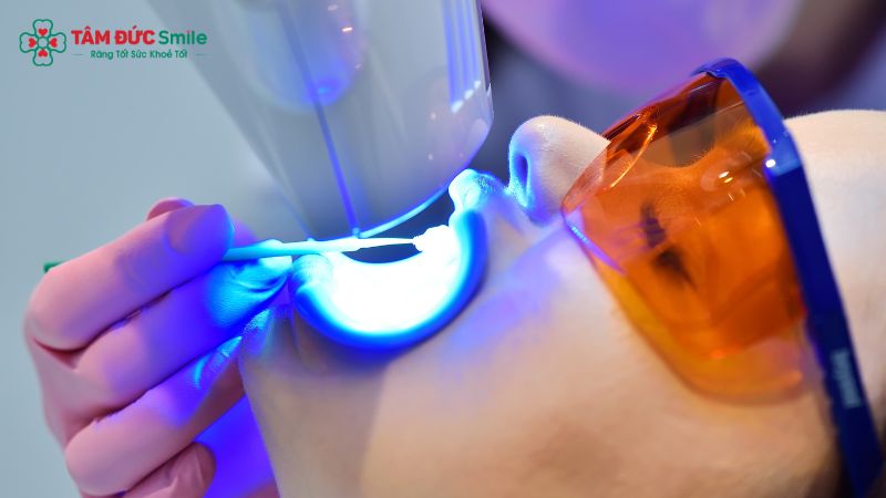 Quy trình tẩy trắng răng tại Nha khoa Tâm Đức Smile được thực hiện cẩn thận từ thăm khám, cách ly nướu, bôi thuốc đến kiểm tra kết quả sau điều trị.