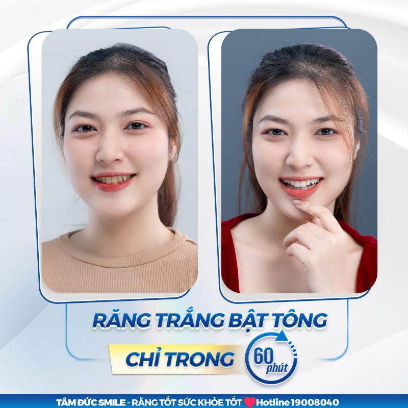 tay-trang-rang-7