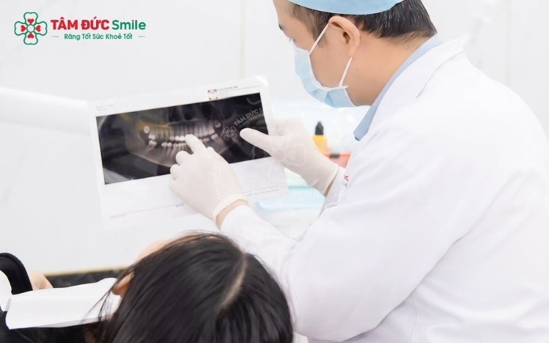 Đánh giá chính xác mật độ xương hàm qua phim CT 3D giúp bác sĩ lập kế hoạch cấy ghép chính xác, hạn chế tối đa xâm lấn và giảm thiểu đau nhức