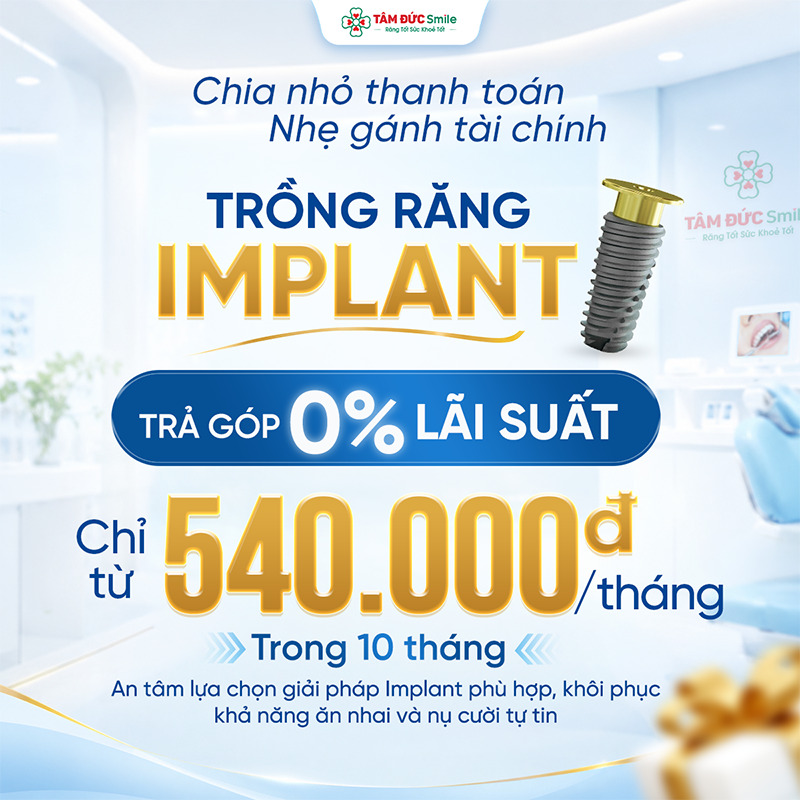 Chính sách trả góp
