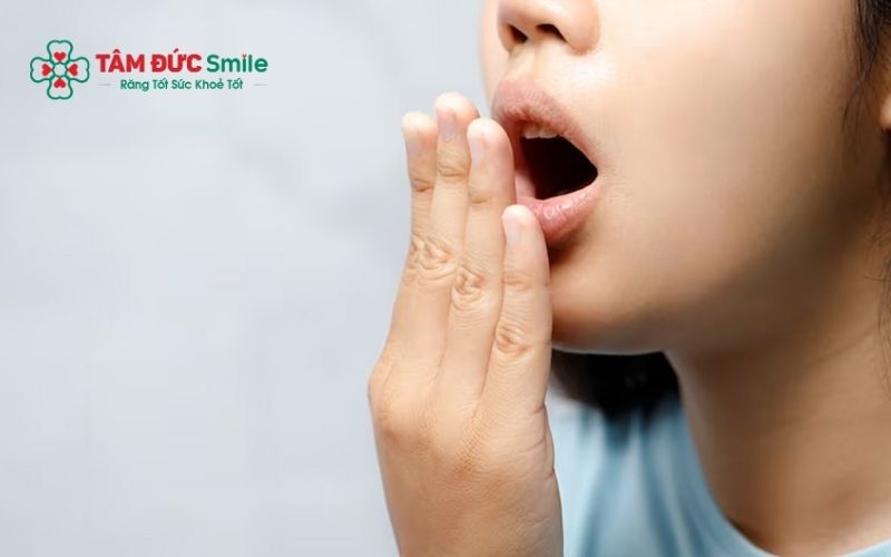 Viêm lợi trùm răng khôn gây triệu chứng sưng đau, hôi miệng, sốt, nổi hạch...