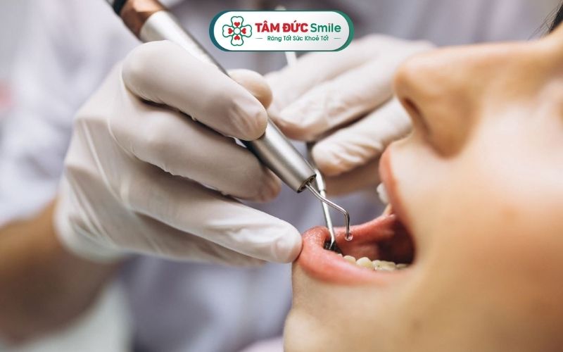 Để chẩn đoán viêm lợi trùm răng khôn, bác sĩ cần thực hiện các bước thăm khám lâm sàng và cận lâm sàng