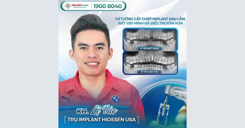 yeu-to-danh-gia-dia-chi-trong-rang-implant-tai-quan-9