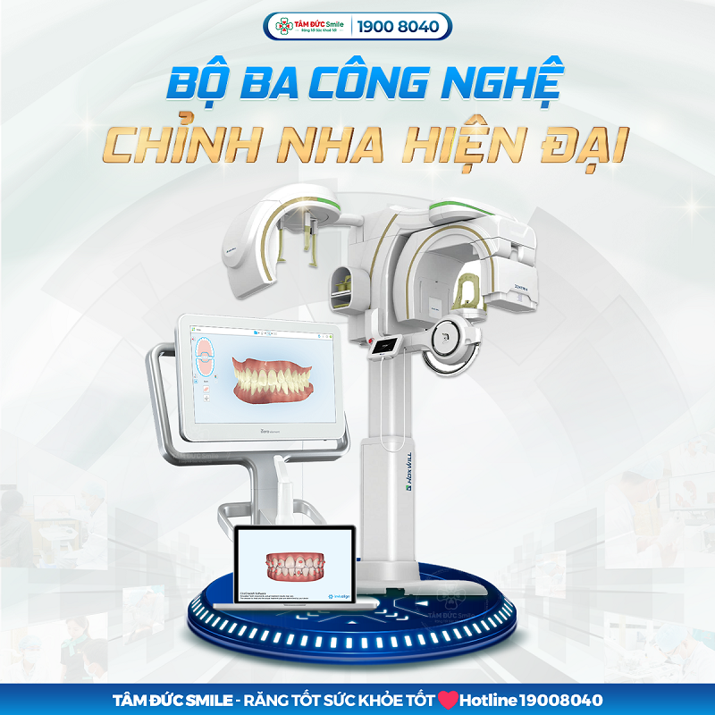 chinh-nha-11