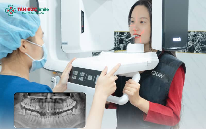 Công nghệ CT Cone Beam 3D giúp bác sĩ quan sát toàn diện cấu trúc răng và xương hàm