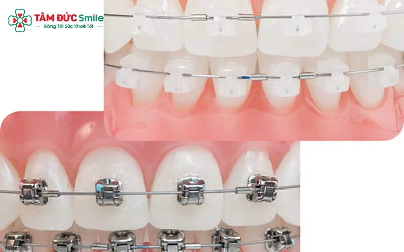 Quý khách có thể lựa chọn chất liệu gắn mắc phù hợp
