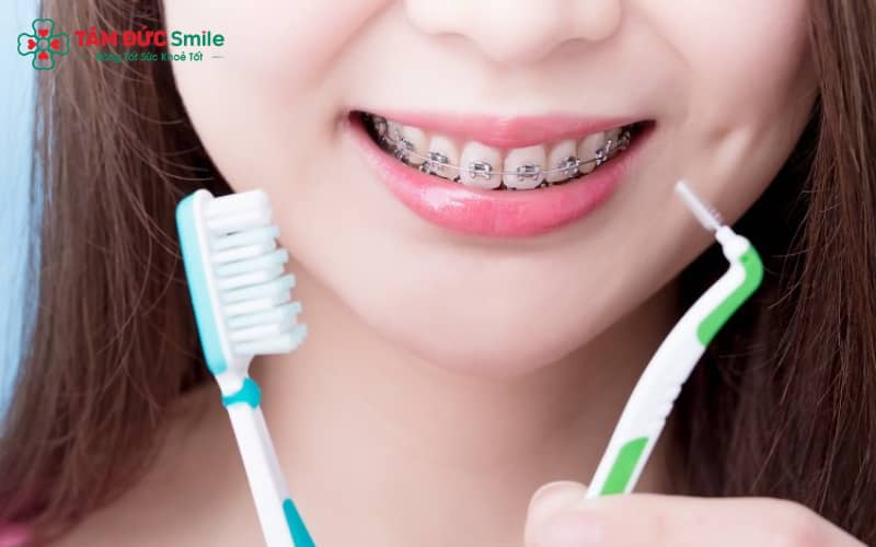 Dụng cụ vệ sinh chuyên dụng giúp làm sạch hiệu quả sau khi gắn mắc cài