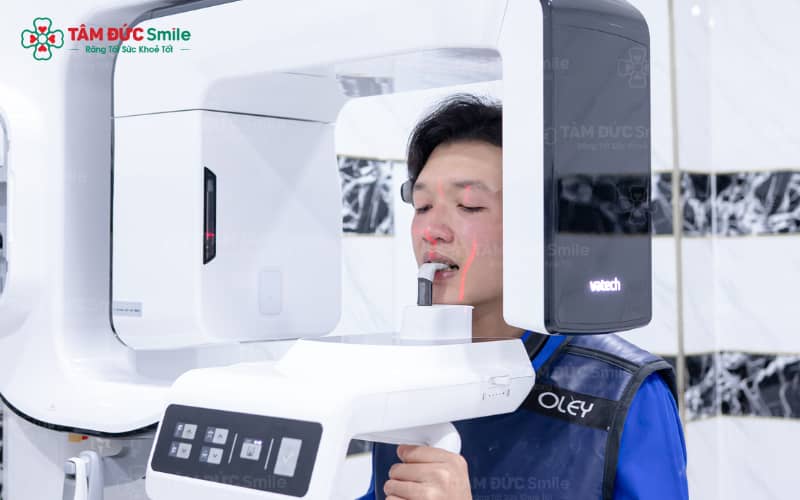 Chụp phim Cone Beam CT hỗ trợ chẩn đoán chính xác tại Tâm Đức Smile