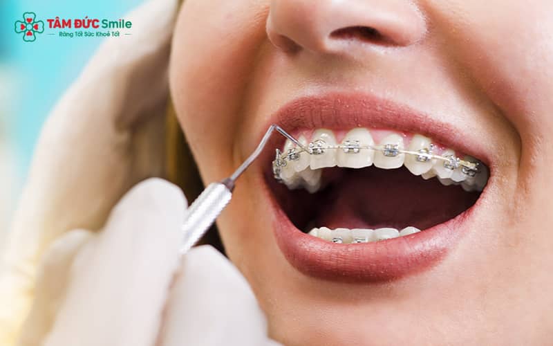 Việc tái khám định kỳ 4–6 tuần giúp đảm bảo hiệu quả điều trị