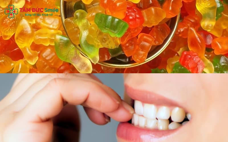Tránh kẹo dẻo, cắn móng tay để bảo vệ mắc cài khi niềng răng