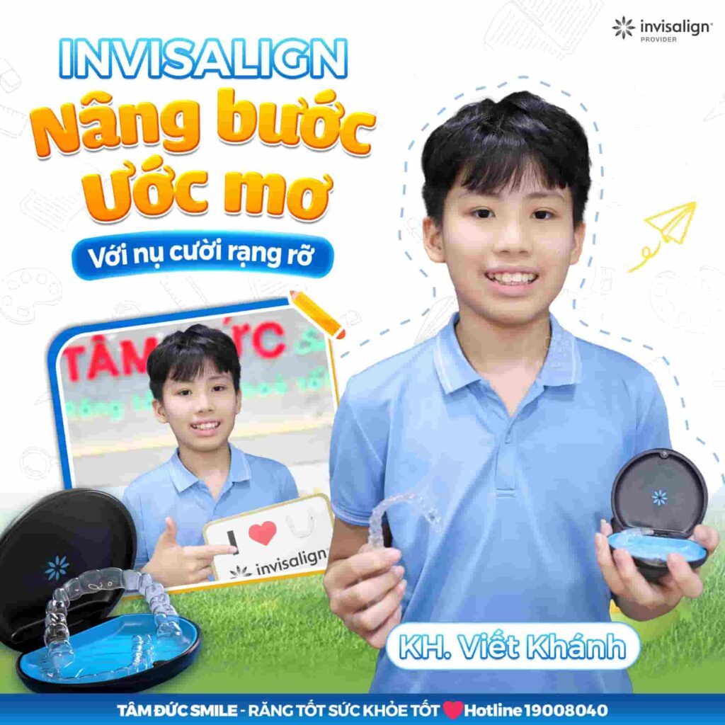 Chỉnh nha Invisalign First cho trẻ giúp tối ưu thẩm mỹ và sự thoải mái